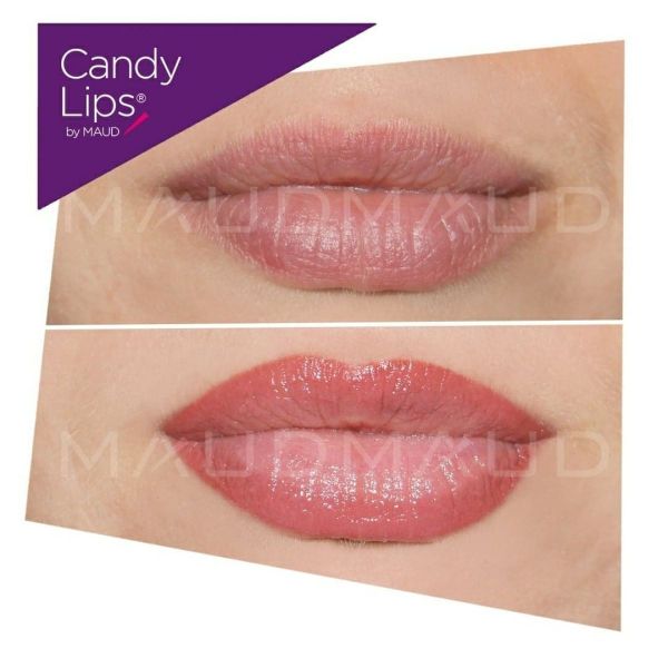 Candy Lips